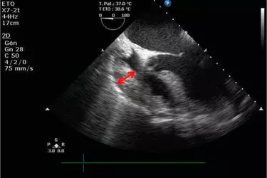 2D Echocardiography in Bhiwadi, Cost of 2D Echo in Bhiwadi, Echocardiography of Heart in Bhiwadi, Echo Test in Bhiwadi, Stress Echocardiography in Bhiwadi, Best echo centre in Bhiwadi.
