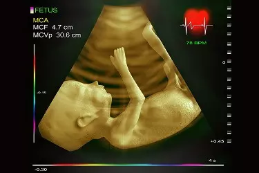 foetal echocardiography in Bhiwadi, cost of foetal echo in Bhiwadi, best radiologist for doing foetal echo in Bhiwadi, best diagnostic centre in Bhiwadi
